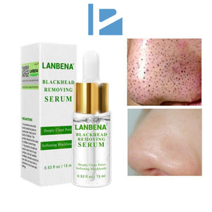 Amolecedor para Remoção de Acne