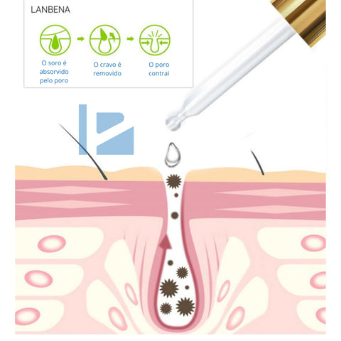 Image of Amolecedor para Remoção de Acne