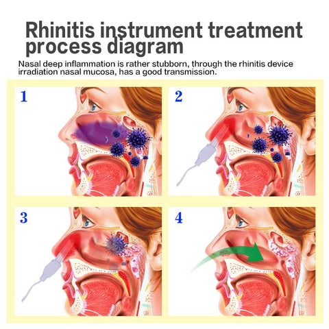 Image of Aparelho Terapêutico para Rinite e Sinusite